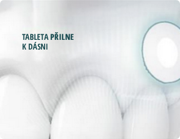 Detailní záběr na zuby se zvýrazněnou oblastí dásně, zdůrazňující potřebu přilnutí pro účinné umístění bukální tablety.