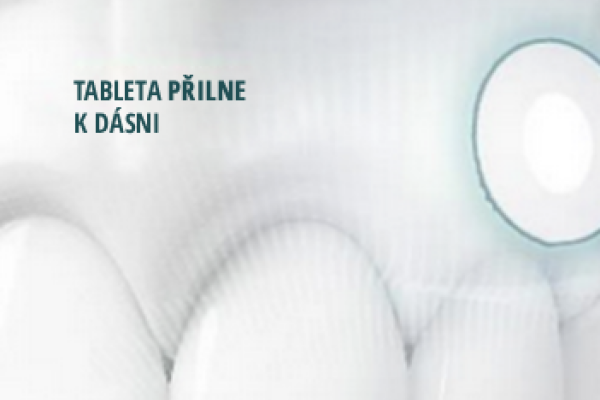 Detailní záběr na zuby se zvýrazněnou oblastí dásně, zdůrazňující potřebu přilnutí pro účinné umístění bukální tablety.